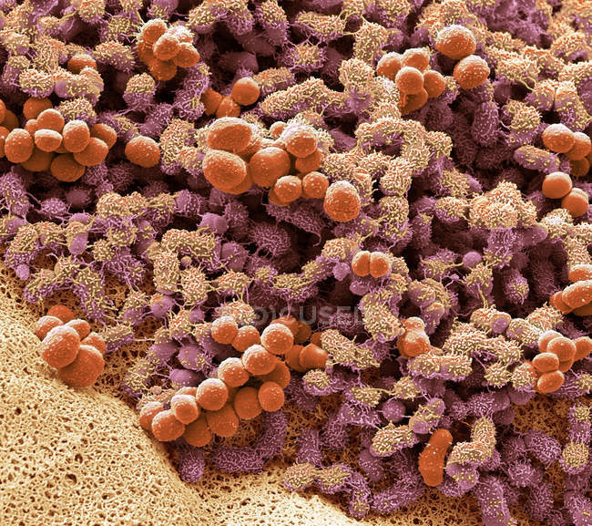 Micrografía electrónica de barrido de Brevibacteria en los pies humanos causando olor . - foto de stock
