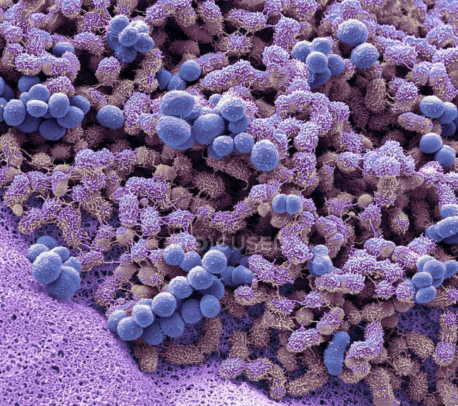 Rasterelektronenmikroskopie von Brevibakterien an menschlichen Füßen, die Gerüche verursachen. — Stockfoto