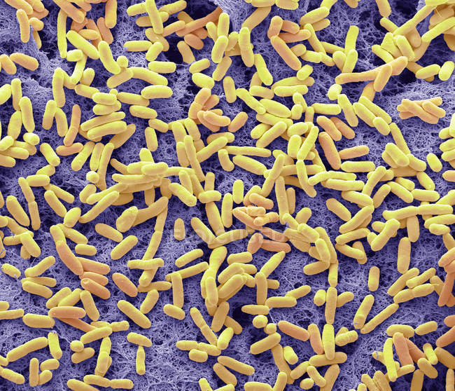 Micrógrafo electrónico de barrido coloreado de bacterias gramnegativas en forma de barra Escherichia coli del intestino humano . - foto de stock