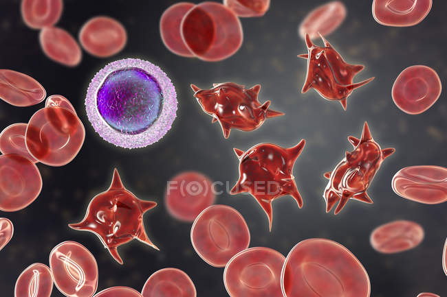Иллюстрация аномальных красных кровяных телец, известных как акантоциты шпоры . — стоковое фото