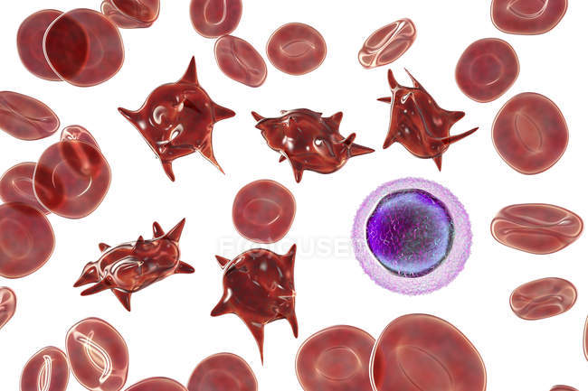 Ілюстрація аномальних еритроцитів, відомих як спонтанні клітини акантоцитів . — стокове фото