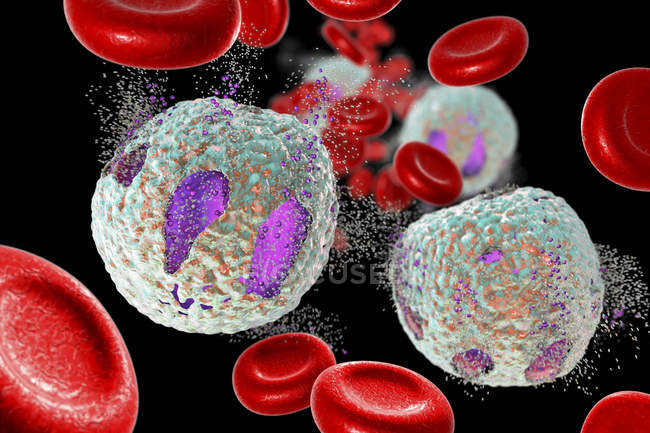 Ilustración digital que muestra destrucción de linfocitos, concepto de tratamiento de la leucemia linfoblástica aguda
. - foto de stock