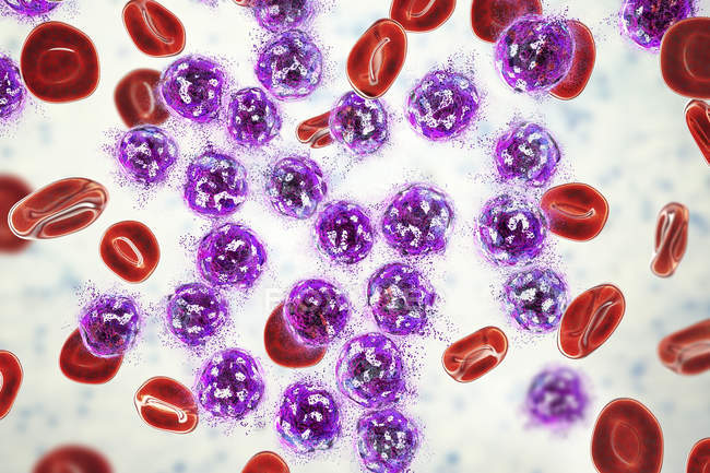 Illustrazione digitale che mostra la distruzione delle cellule linfoblastiche, concetto di trattamento della leucemia linfoblastica acuta . — Foto stock