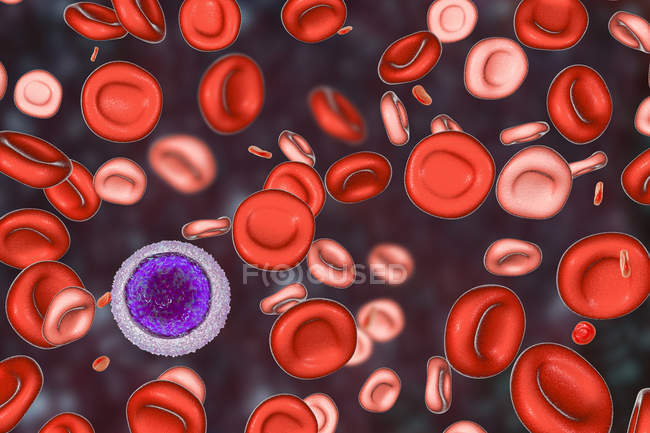 Ilustración digital de glóbulos rojos hipocrómicos y microcíticos mientras que la anemia ferropénica
. - foto de stock