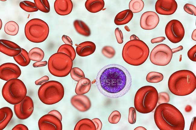 Illustration numérique des globules rouges hypochromiques et microcytaires lors d'une anémie ferriprive . — Photo de stock