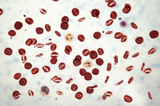 Цифровая иллюстрация, показывающая эритроциты, тромбоциты, нейтрофилы, моноциты и лимфоциты в нормальном мазке крови
. — стоковое фото