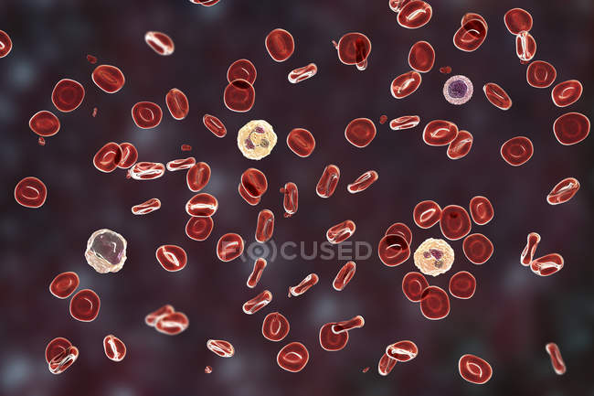 Цифровая иллюстрация, показывающая эритроциты, тромбоциты, нейтрофилы, моноциты и лимфоциты в нормальном мазке крови
. — стоковое фото