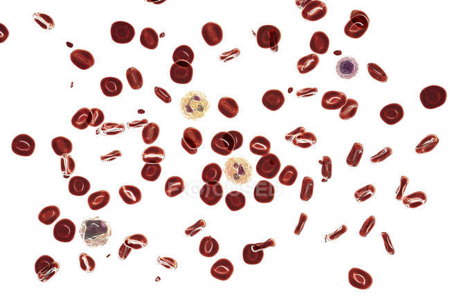 Ilustración digital que muestra glóbulos rojos, plaquetas, neutrófilos, monocitos y linfocitos en frotis sanguíneo normal
. - foto de stock