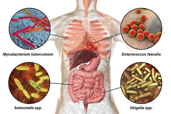 Illustrazione digitale che mostra batteri che causano infezioni dell'apparato respiratorio, del cuore e del tratto digestivo, Mycobacterium tuberculosis, Enterococcus faecalis, Salmonella, Shigella
. — Foto stock