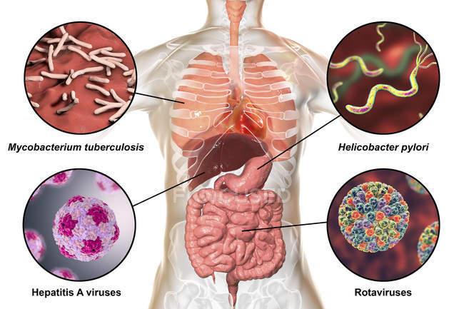 Ilustração digital rotulada mostrando bactérias causadoras de infecções do sistema respiratório e digestivo, Mycobacterium tuberculosis, Helicobacter pylori, Hepatite A, Rotavirus . — Fotografia de Stock