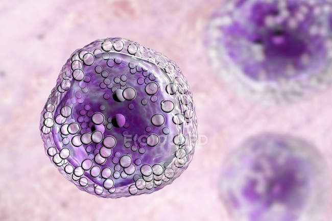 Digital illustration of malignant B-cell lymphocytes in Burkitt lymphoma. — Stock Photo