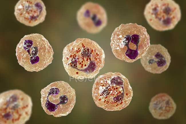Digital illustration showing cerebrospinal fluid containing numerous neutrophils with Neisseria meningitidis bacteria of Meningococcal meningitis. — Stock Photo
