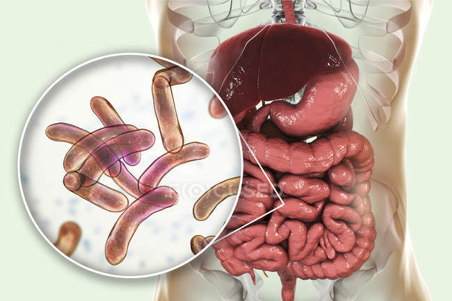 Ilustração digital mostrando close-up de bactérias de infecção de cólera no intestino delgado
. — Fotografia de Stock