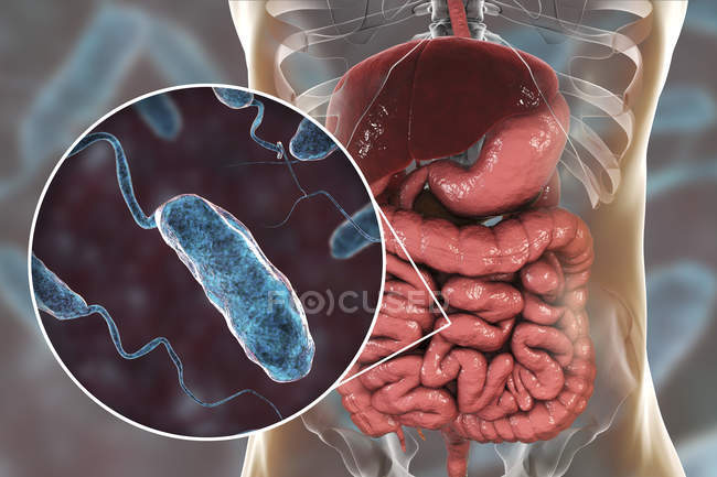 Illustration numérique montrant un gros plan de bactéries cholériques dans l'intestin grêle . — Photo de stock