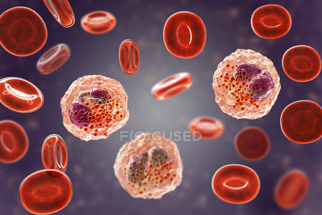 Frotis de sangre eosinofilia con numerosos eosinófilos, ilustración digital . - foto de stock