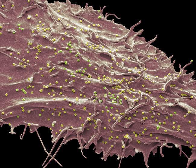 Células humanas infectadas con el virus de inmunodeficiencia de Simian por mangabey hollín, micrografía electrónica de barrido de color . - foto de stock