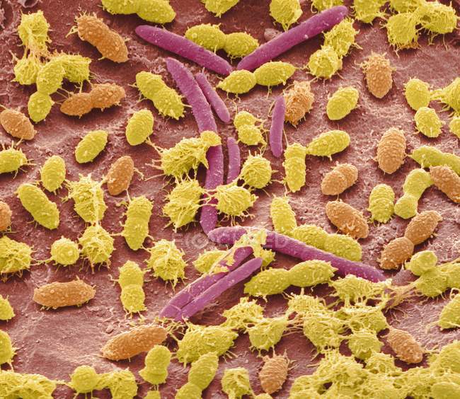 Micrografía electrónica de barrido de bacterias fecales cultivadas a partir de muestras de heces humanas . - foto de stock