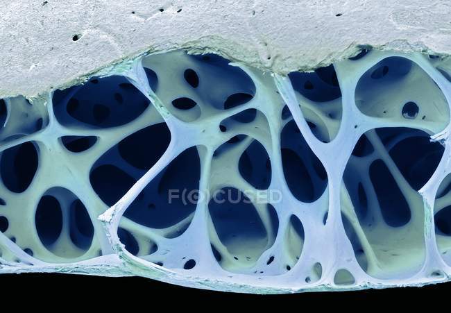 Colored scanning electron micrograph of cancellous bone tissue from starling bird skull. — Stock Photo