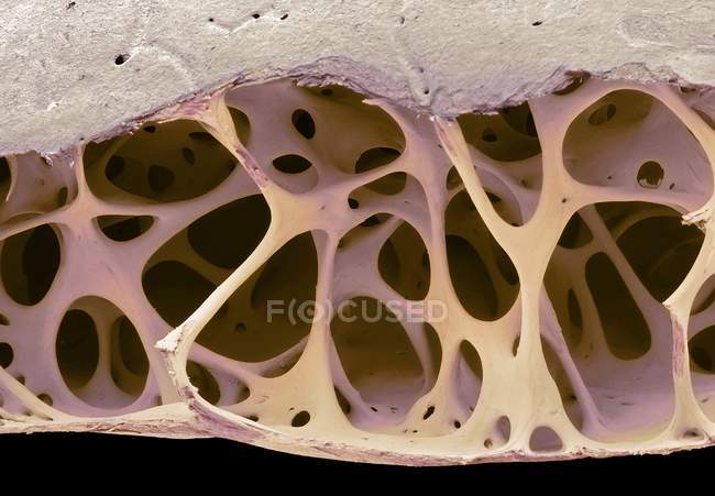 Micrografia eletrônica de varredura colorida de tecido ósseo cancelado de crânio de pássaro estorninho . — Fotografia de Stock