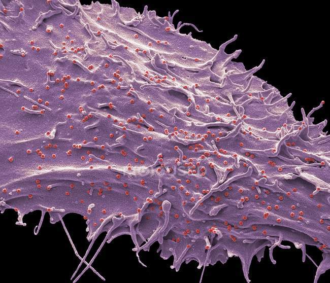 Людської клітини, інфіковані Мавпячої вірусу імунодефіциту від закопчений mangabey, кольорові сканування електронна мікрофотографія. — стокове фото