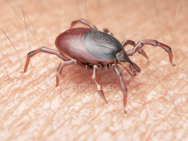 Illustration des auf der menschlichen Hautoberfläche kriechenden Zeckenparasiten. — Stockfoto