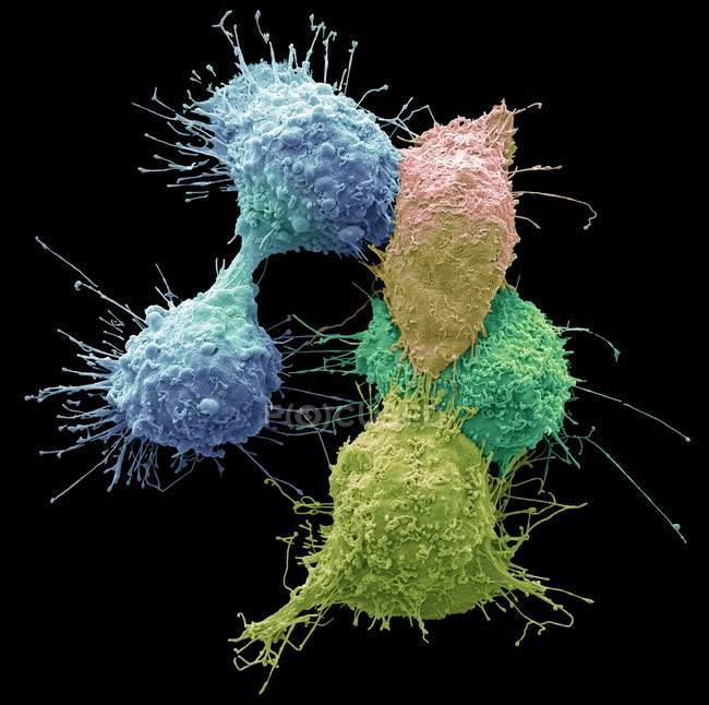 Micrógrafo electrónico de barrido coloreado de células cancerosas de ovario
. - foto de stock