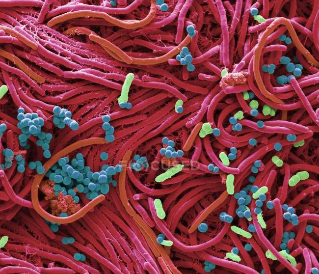 Micrografia eletrônica de varredura colorida de bactérias cultivadas na superfície do telefone móvel
. — Fotografia de Stock
