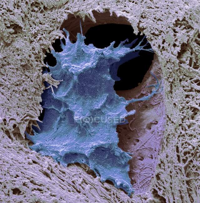 Coloured scanning electron micrograph of osteocyte bone cell surrounded by bone tissue. — Stock Photo