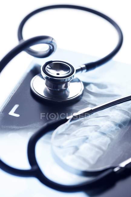 X-ray of neck with stethoscope, close-up. — Stock Photo
