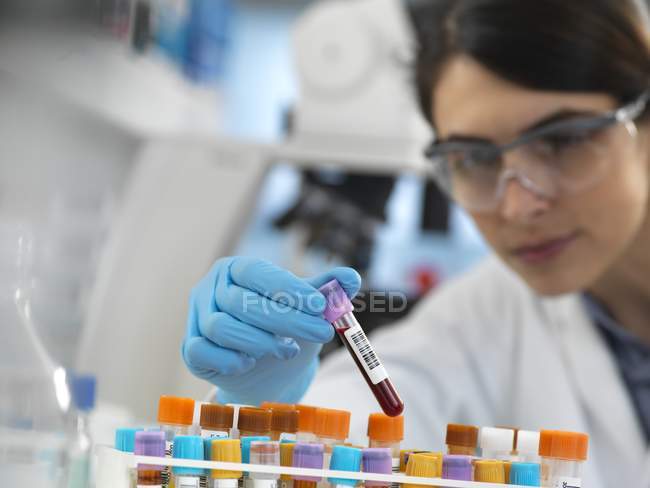 Wissenschaftler wählt menschliche Blutprobe im Labor aus. — Stockfoto