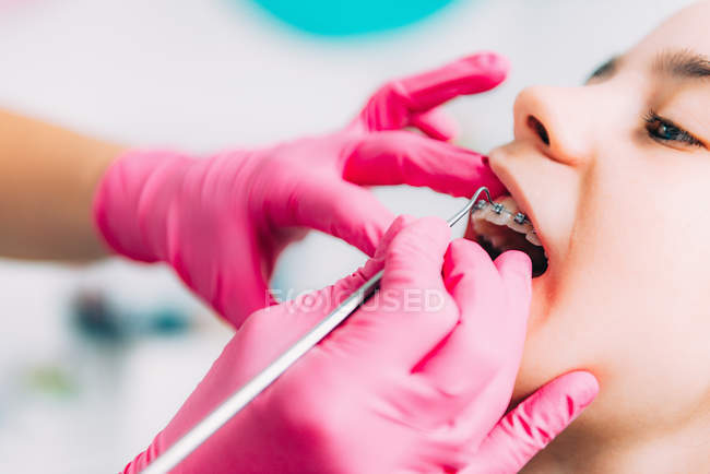 Female orthodontist fixing dental braces of girl in clinic. — Stock Photo