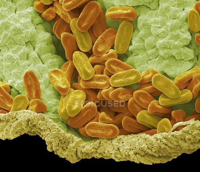 Coloured scanning electron micrograph of pollen grains from Verbena bonariensis perennial plant. — Stock Photo