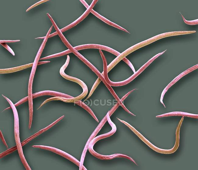 Micrographie électronique à balayage coloré du parasite nématode microscopique Phasmarhabditis hermaphrodita de Rhabditidae . — Photo de stock