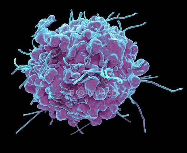 Coloured scanning electron micrograph of 293T cell in early stage of programmed apoptosis cell death. — Stock Photo