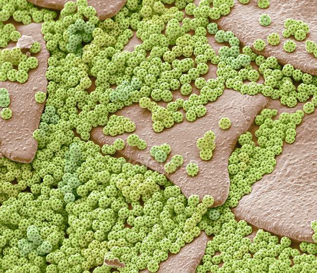 Farbige Rasterelektronenmikroskopie Feingliedrig strukturierte mikroskopische Brochosomen Granulat sezerniert durch Blatttrichter. — Stockfoto