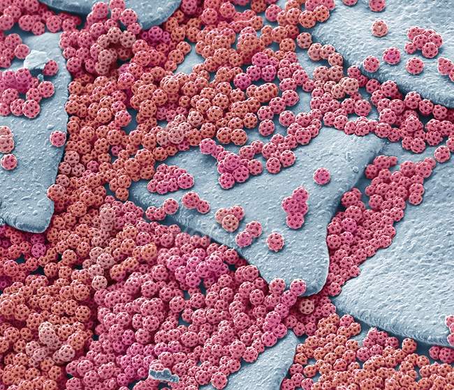 Micrografia eletrônica de varredura colorida Folheto microscópico intrincadamente estruturado grânulos secretados por conta-gotas . — Fotografia de Stock