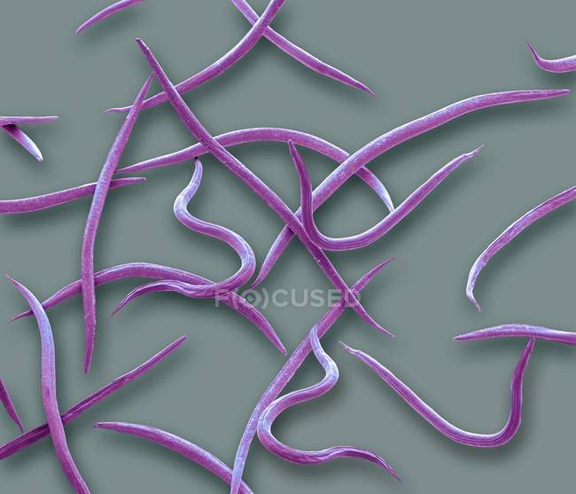 Coloured scanning electron micrograph of Phasmarhabditis hermaphrodita microscopic nematode parasite of Rhabditidae. — Stock Photo