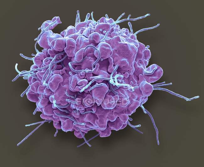 Цветной сканирующий электронный микрограф 293T-клетки на ранней стадии запрограммированной гибели клеток апоптоза . — стоковое фото