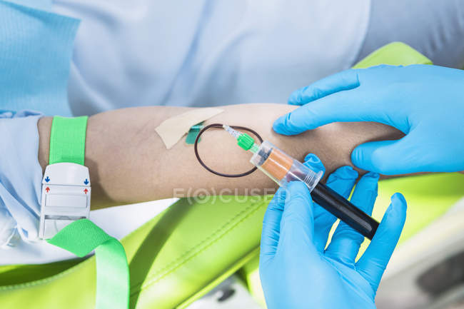 Primer plano del médico que extrae sangre del paciente femenino para el tratamiento de cosméticos PRP . - foto de stock