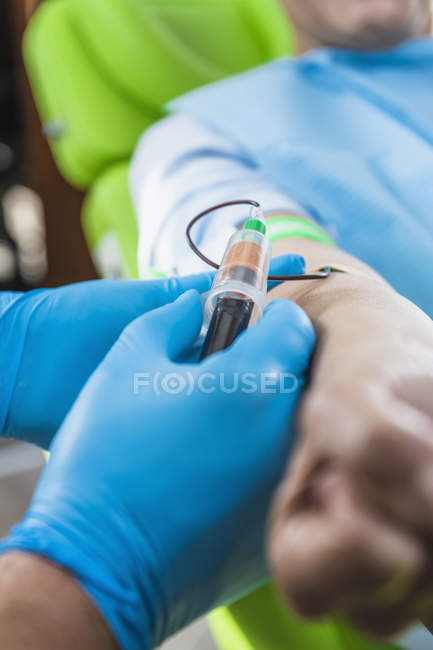 Close-up do médico desenhando sangue de paciente feminino para o tratamento de cosméticos PRP . — Fotografia de Stock