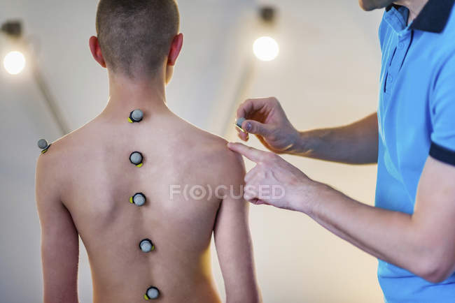 Фізіотерапевт розміщення відображає маркування кулі для аналізу постави для хлопчика-підлітка. — стокове фото
