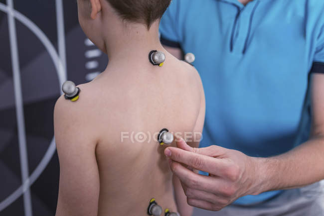 Fisioterapeuta colocando bolas de marcação reflexiva na criança de volta para análise postural . — Fotografia de Stock