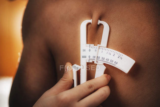 Medico che misura il grasso corporeo su sottocutaneo utilizzando pinze test su atleta di sesso maschile . — Foto stock