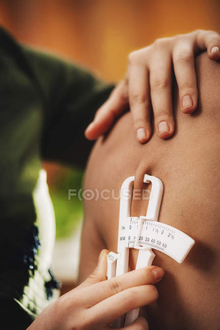 Medico che misura il grasso corporeo su sottocutaneo utilizzando test di spessore della pelle su atleta maschio . — Foto stock