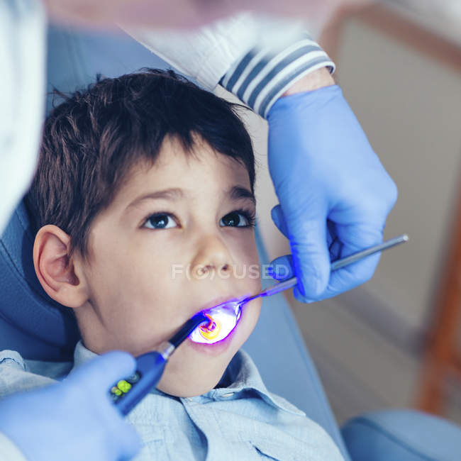 Dentist setting filling with UV light while examining elementary age patient. — Stock Photo