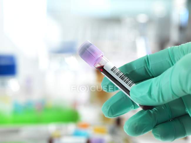 Техник держит образец крови на руках, готовый к тестированию в лаборатории
. — стоковое фото