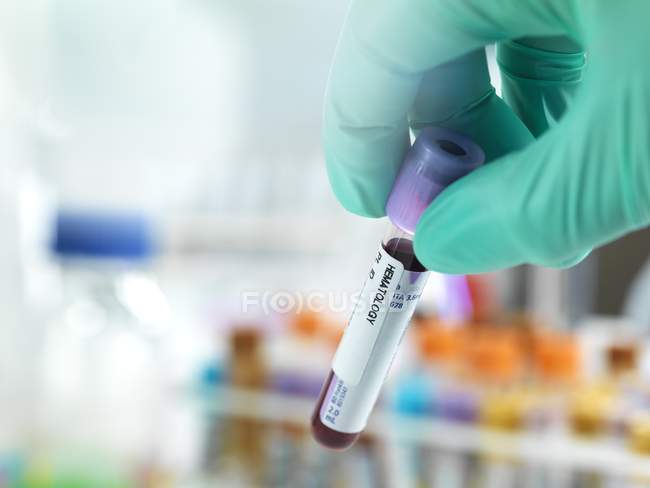 Technicien main tenant un échantillon de sang prêt à être testé en laboratoire . — Photo de stock
