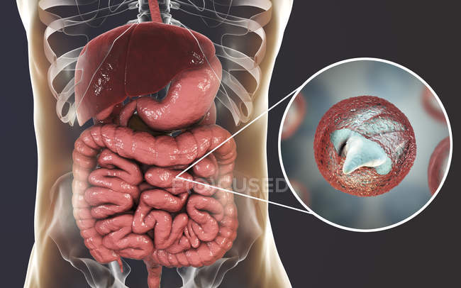 Cryptosporidium parvum parasite in human body causing cryptosporidiosis, digital illustration. — Stock Photo