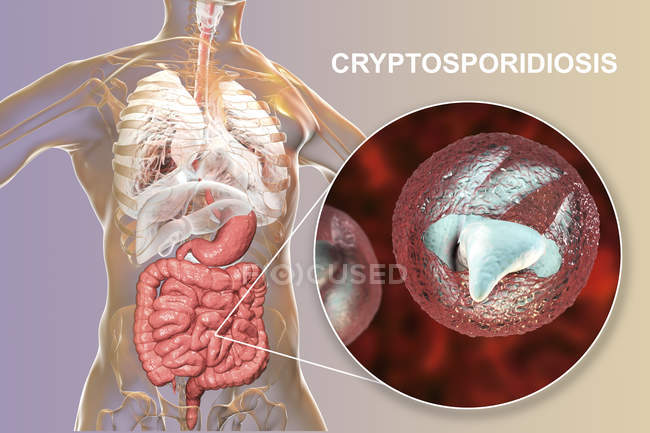 Cryptosporidium parvum parasita no corpo humano causando criptosporidiose, ilustração digital
. — Fotografia de Stock