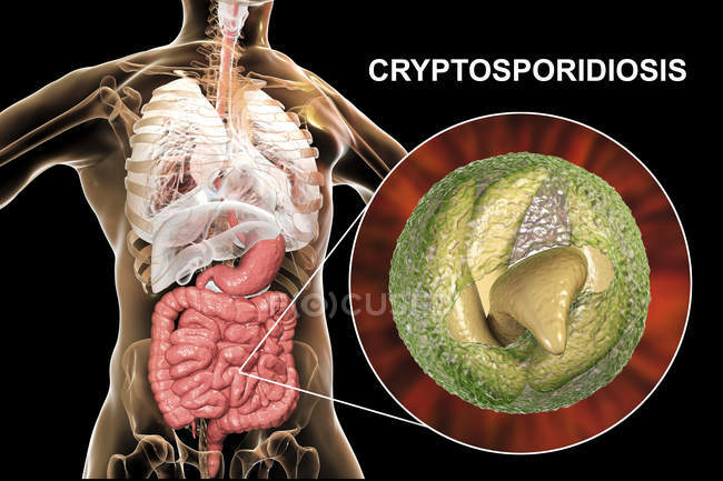 Criptosporidium parvum parásito en el cuerpo humano que causa criptosporidiosis, ilustración digital
. - foto de stock